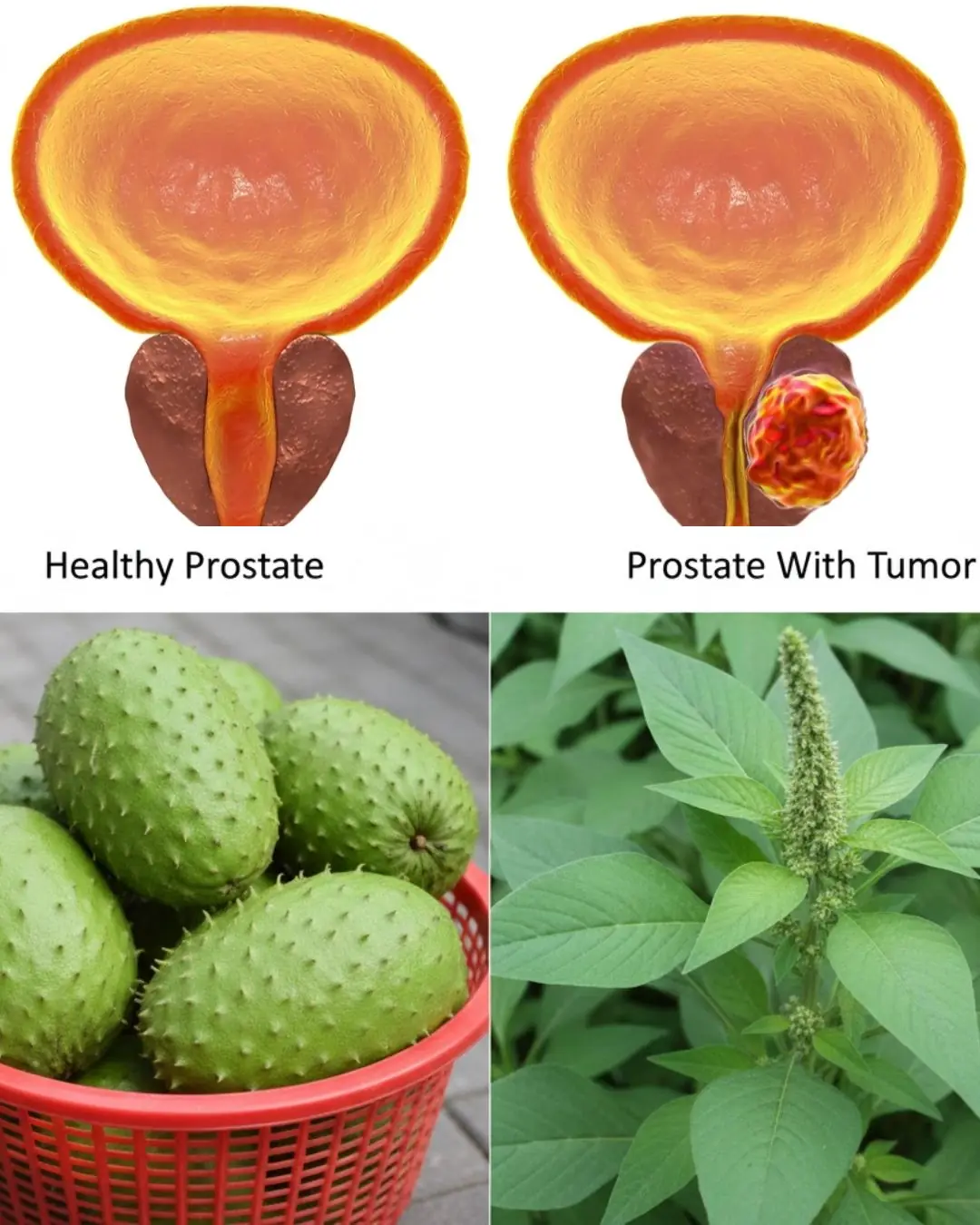 No Man Should Die From Prostate Cancer: The Natural Remedy Every Man Should Know
