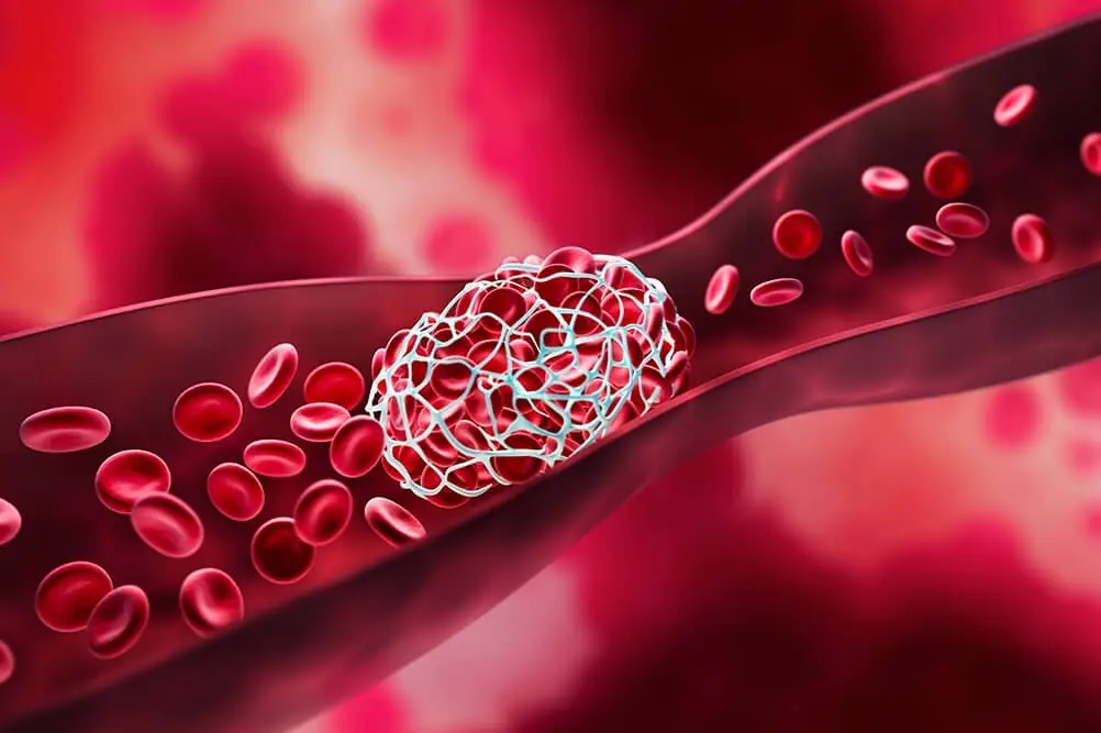 Proven Foods, Supplements and Vitamins That Act as Powerful Natural Blood Thinners