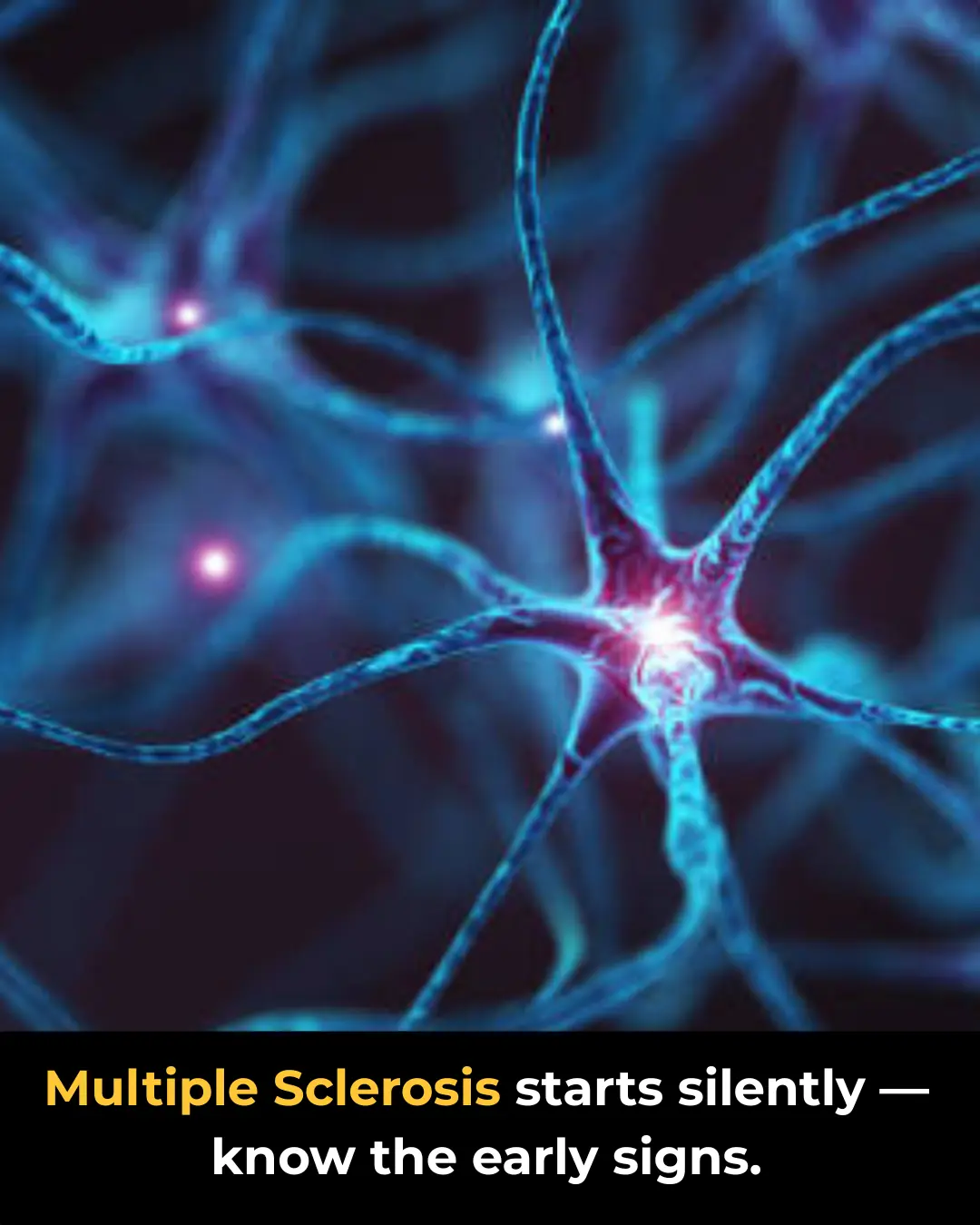 Multiple Sclerosis: First Symptoms You Should Notice