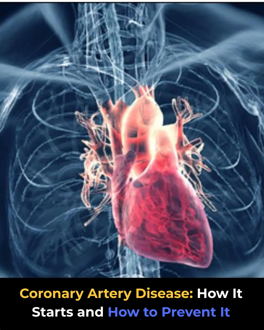 Coronary Artery Disease: How It Starts and How to Prevent It