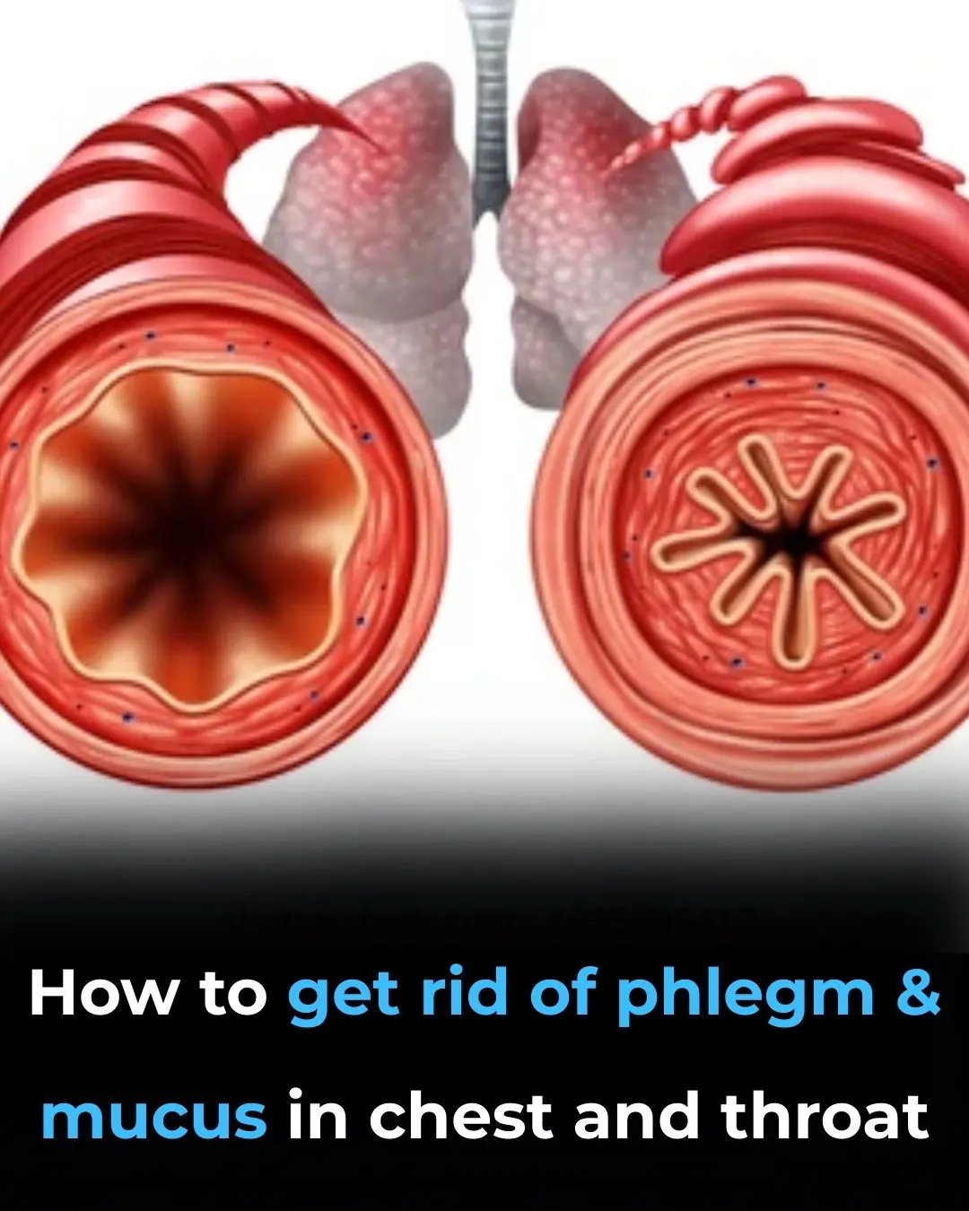 Understanding Phlegm: Why It Builds Up and How to Naturally Reduce It