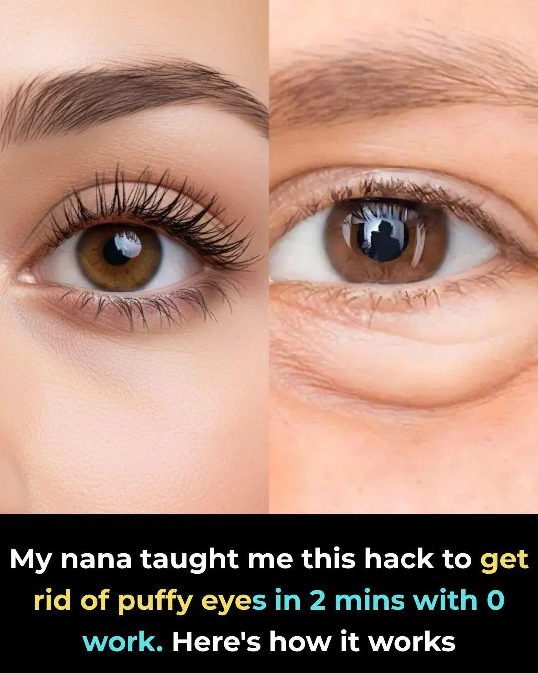 The 2-Minute Potato Trick My Nana Swore By for Puffy Eyes