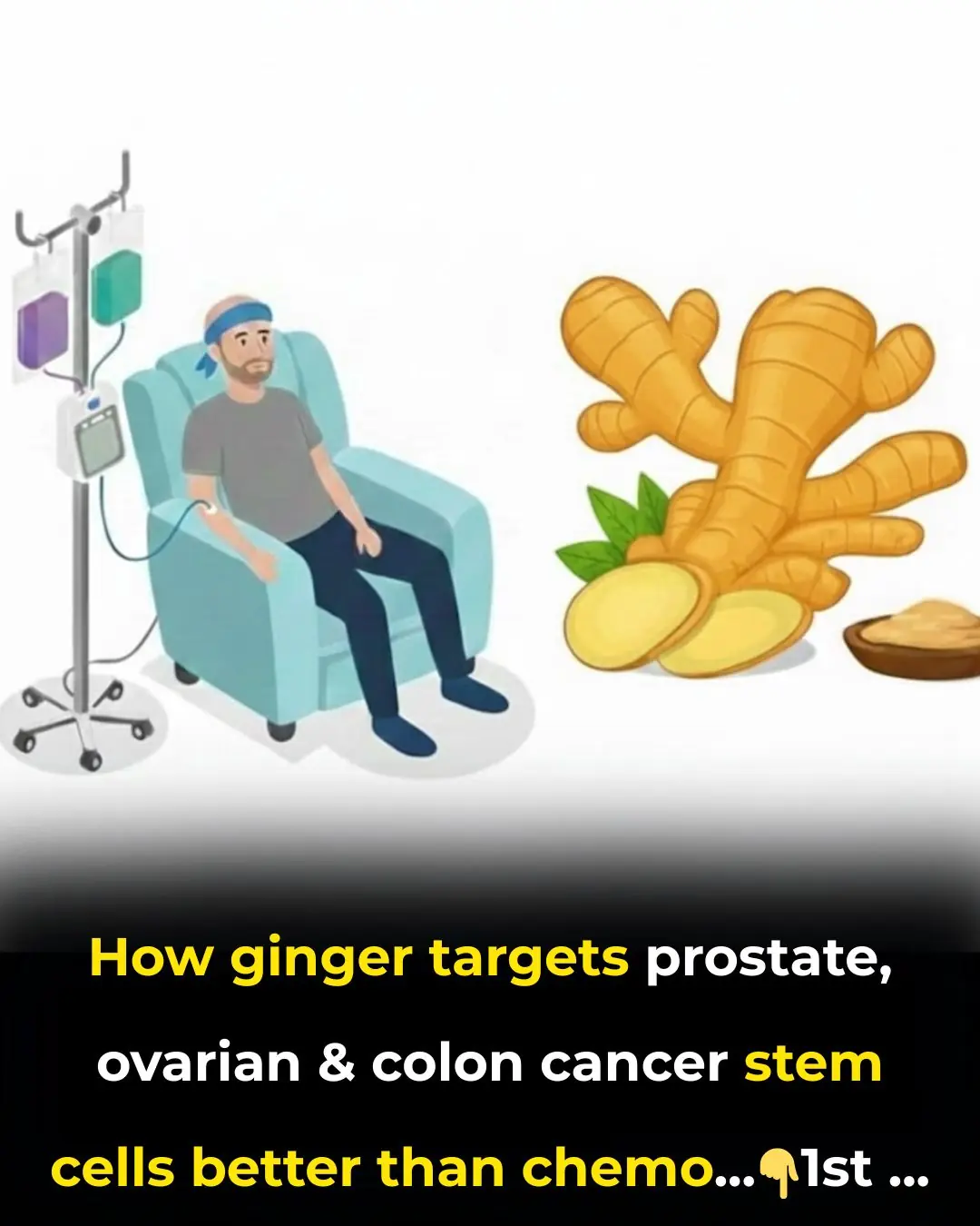 How Ginger Targets Prostate, Ovarian and Colon Cancer Stem Cells Better Than Chemo
