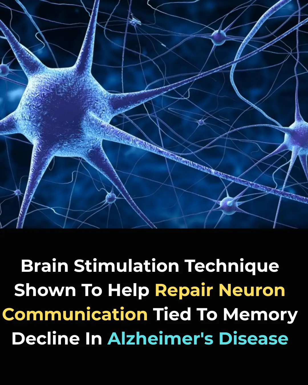 Revolutionary Brain Stimulation Technique Shows Potential to Reverse Alzheimer's Damage!