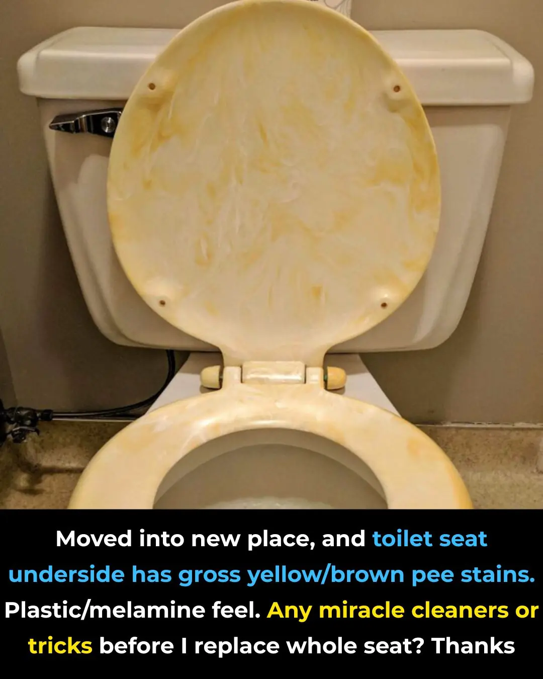 Moved Into a New Place and Found Gross Yellow Stains Under the Toilet Seat? Try These Fixes Before Replacing It