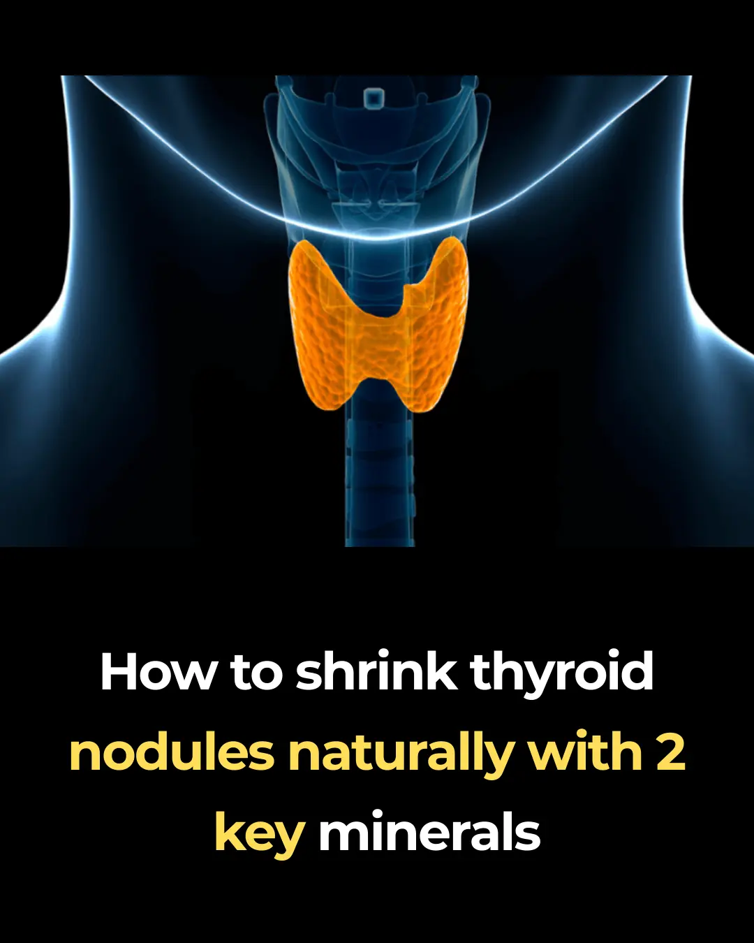 How to shrink thyroid nodules naturally with 2 key minerals