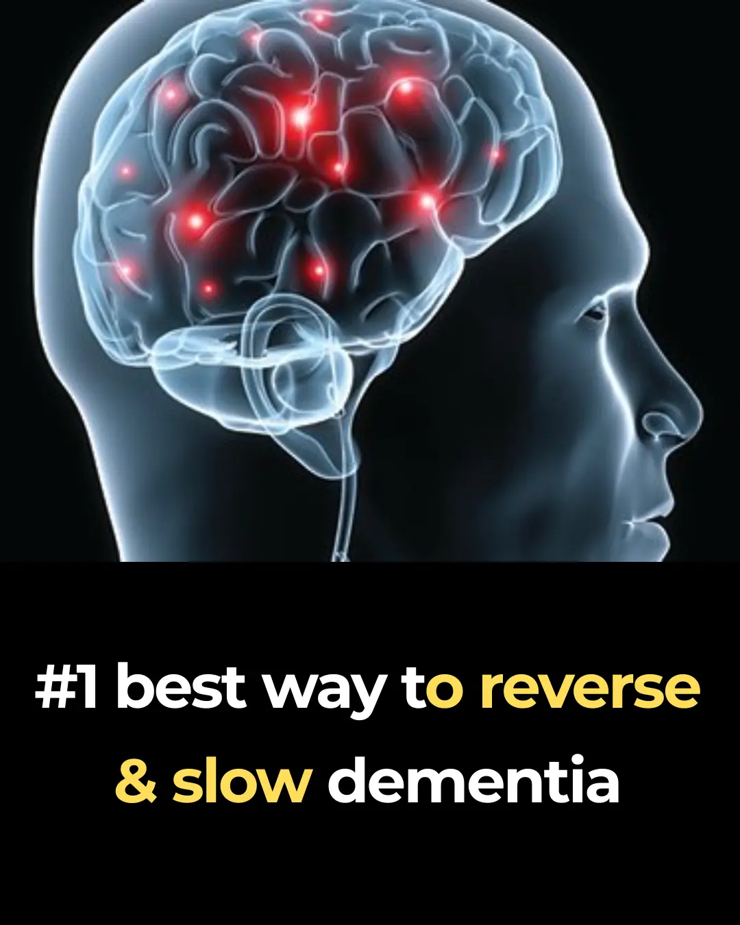 #1 best way to reverse & slow dementia