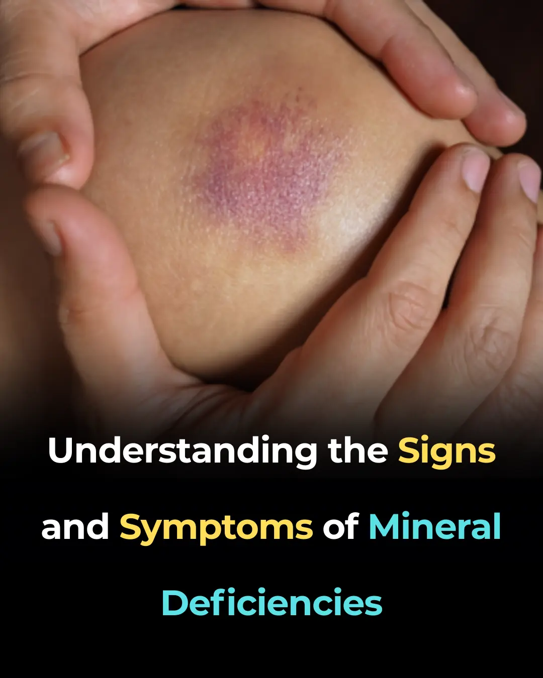 Understanding the Signs and Symptoms of Mineral Deficiencies