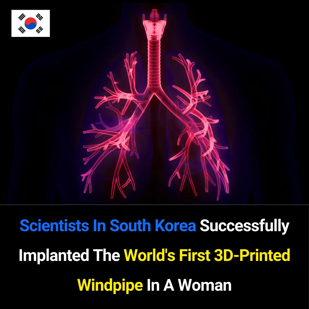 World’s First 3D-Printed Windpipe Successfully Implanted in South Korea