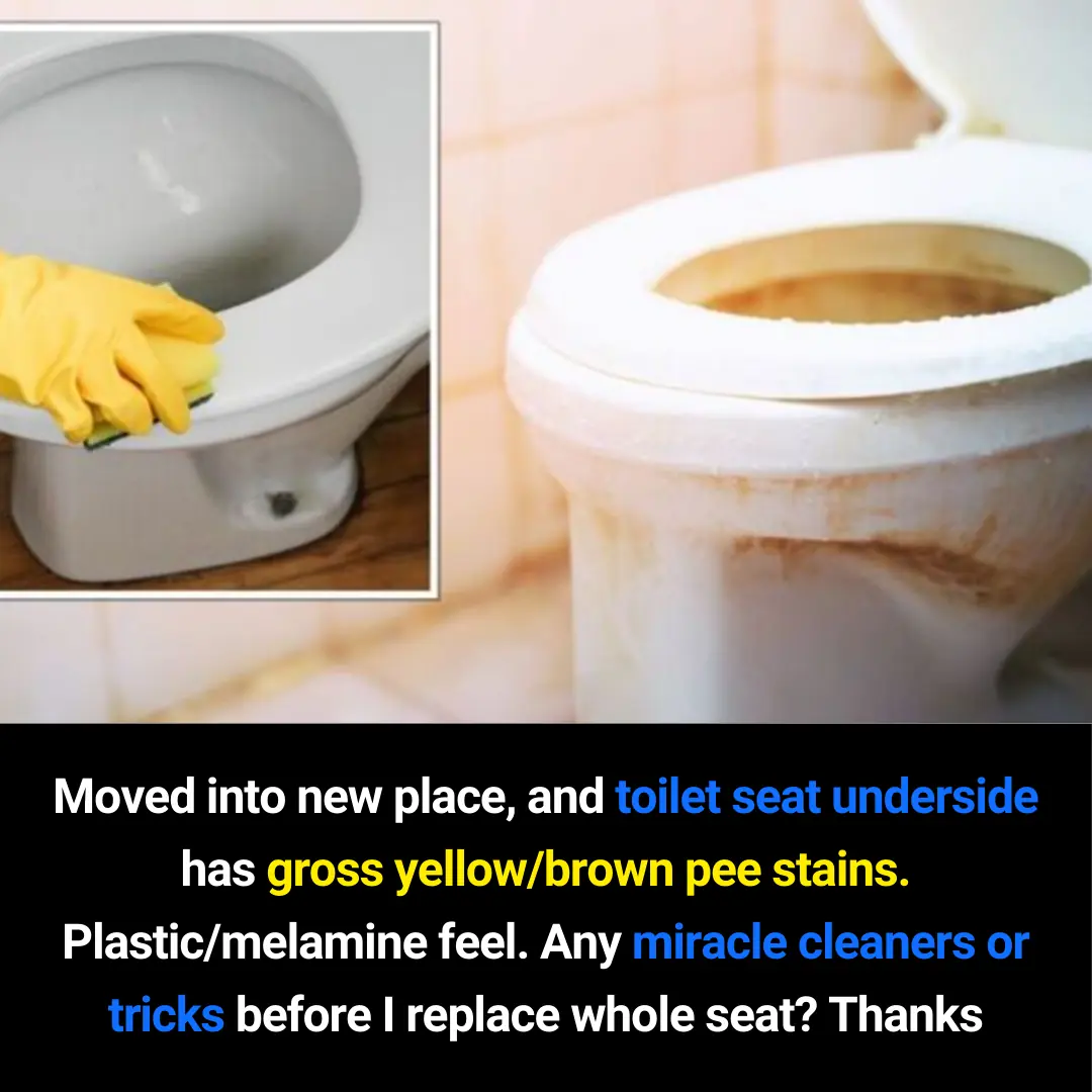 How to Remove Yellow and Brown Stains From a Toilet Seat Before Replacing It