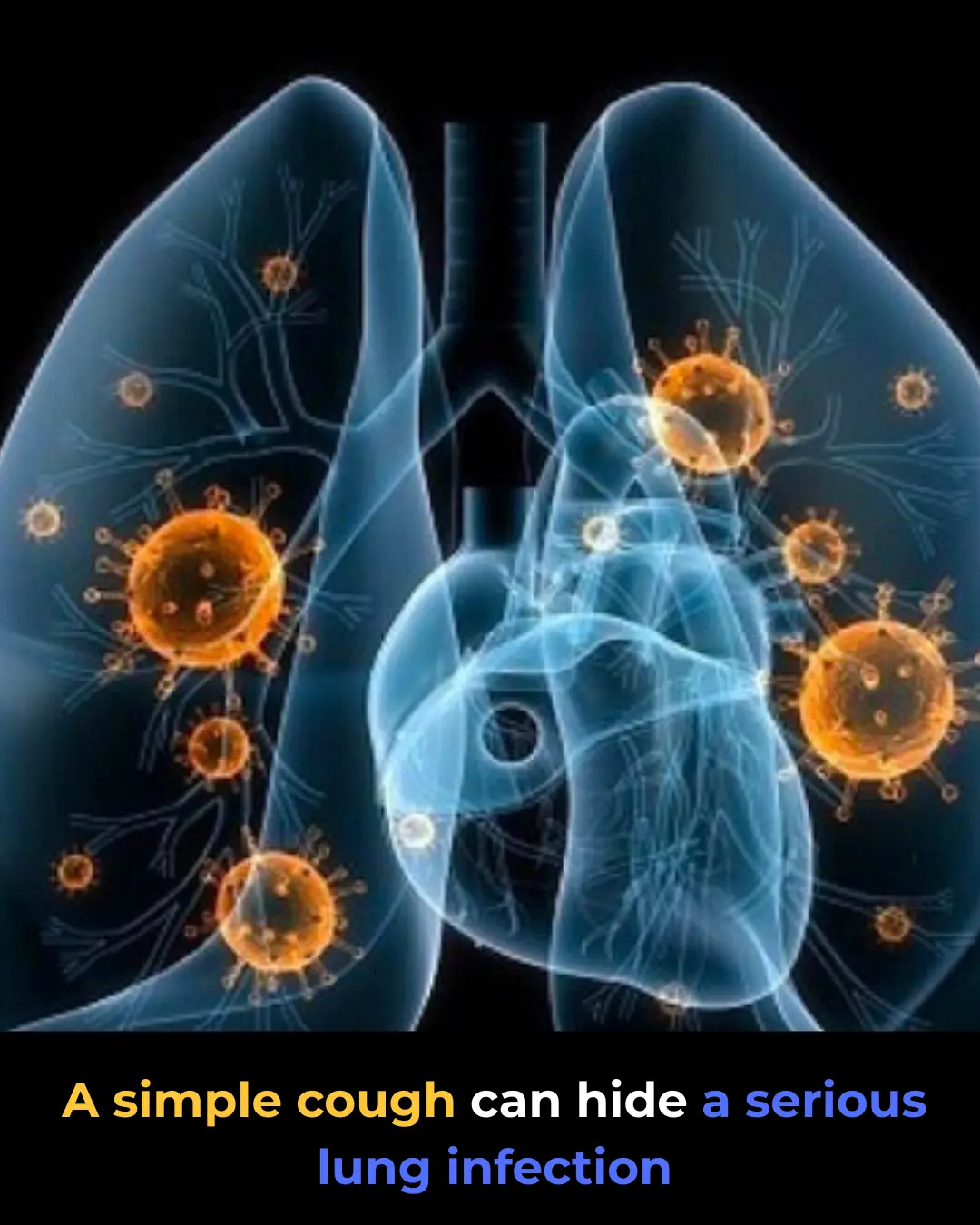 Lung Infections: Common Types and How to Treat Them