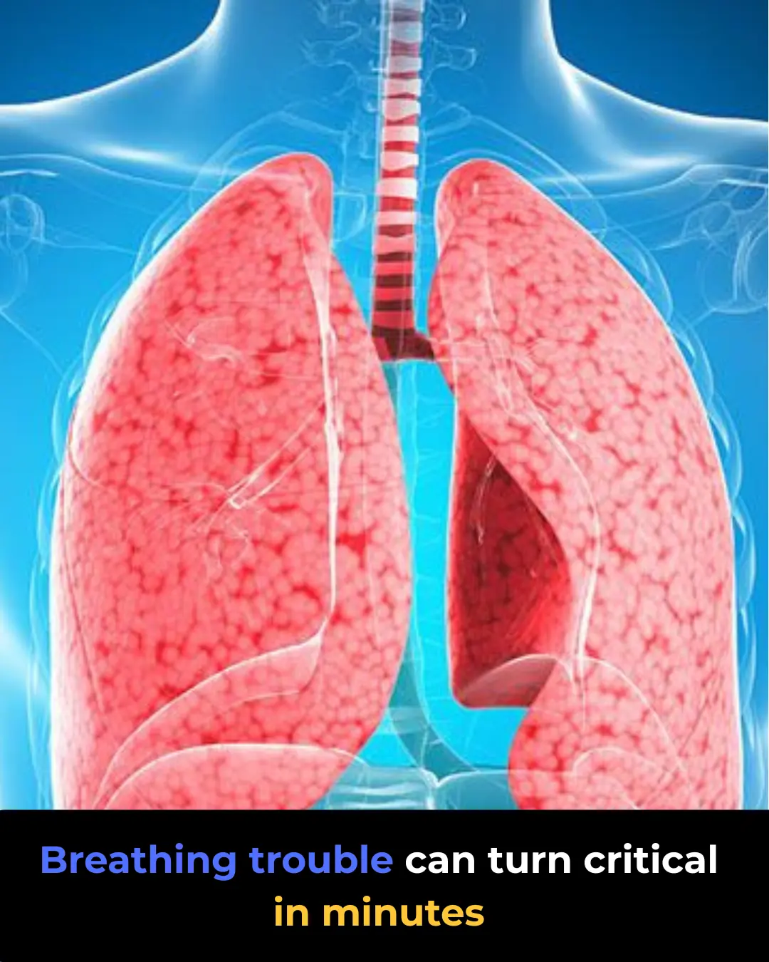 Respiratory Failure: Causes and Emergency Signs