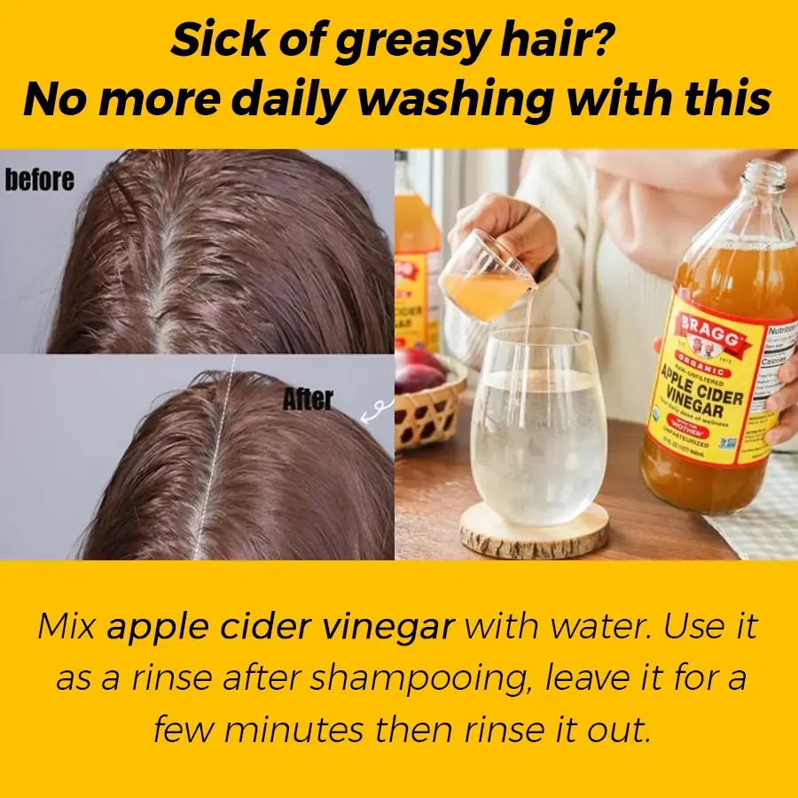 Natural Remedies for Managing Oily Scalp: Effective Tips for Balanced Hair