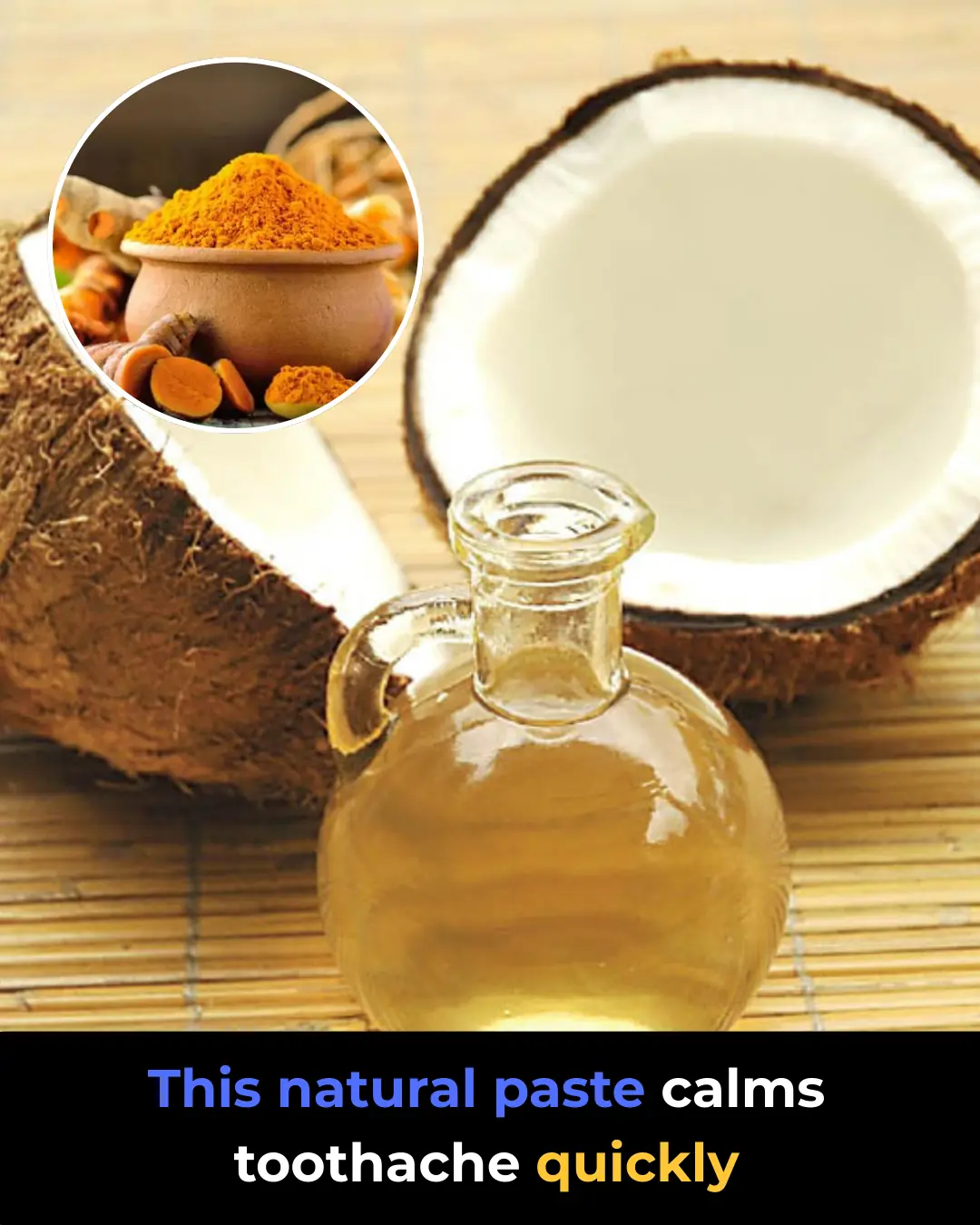 How to Get Rid of Tooth Cavity Naturally: The Most Effective Home Remedy to Reduce Pain Fast