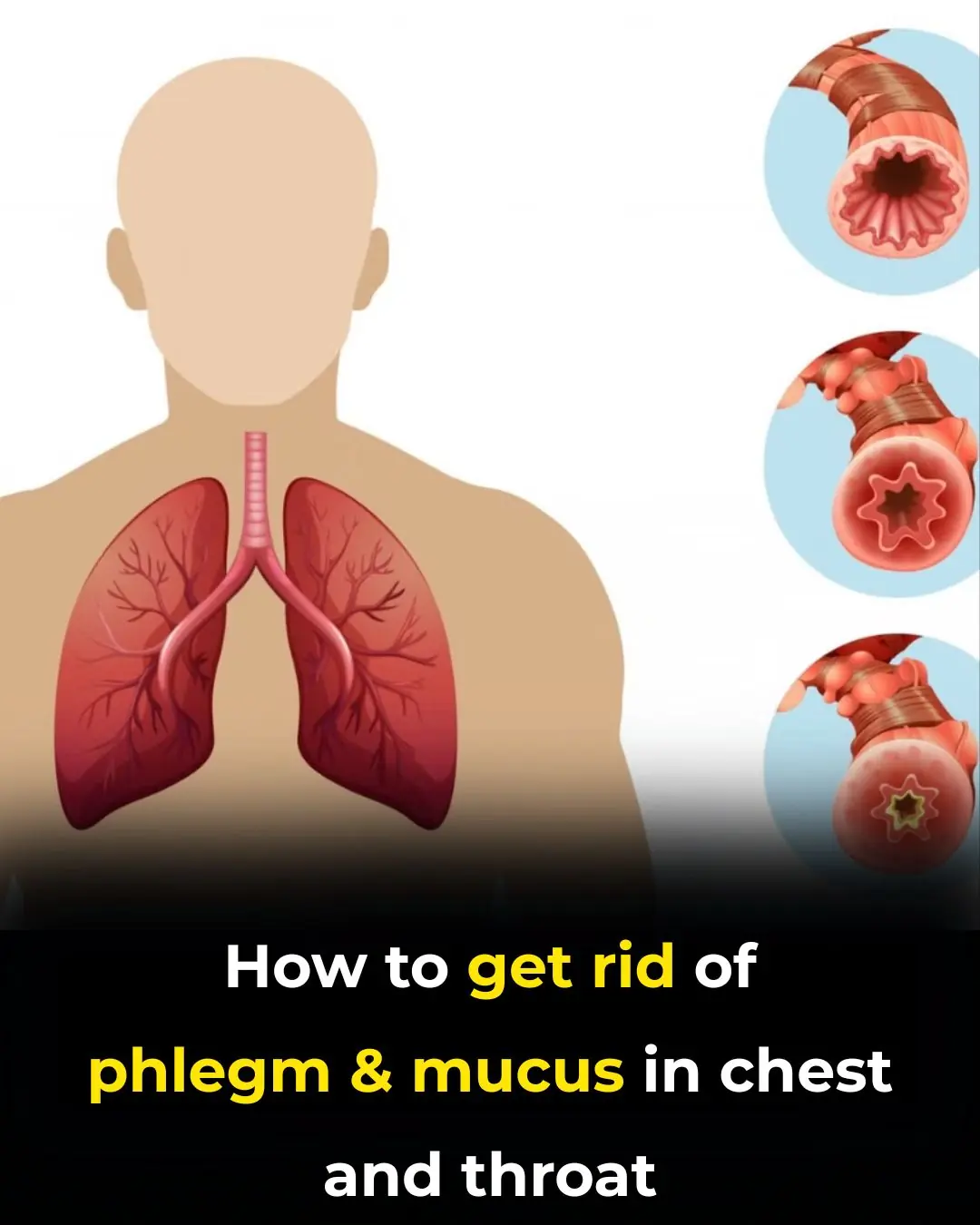 Understanding Phlegm: Why It Builds Up and How to Naturally Reduce It