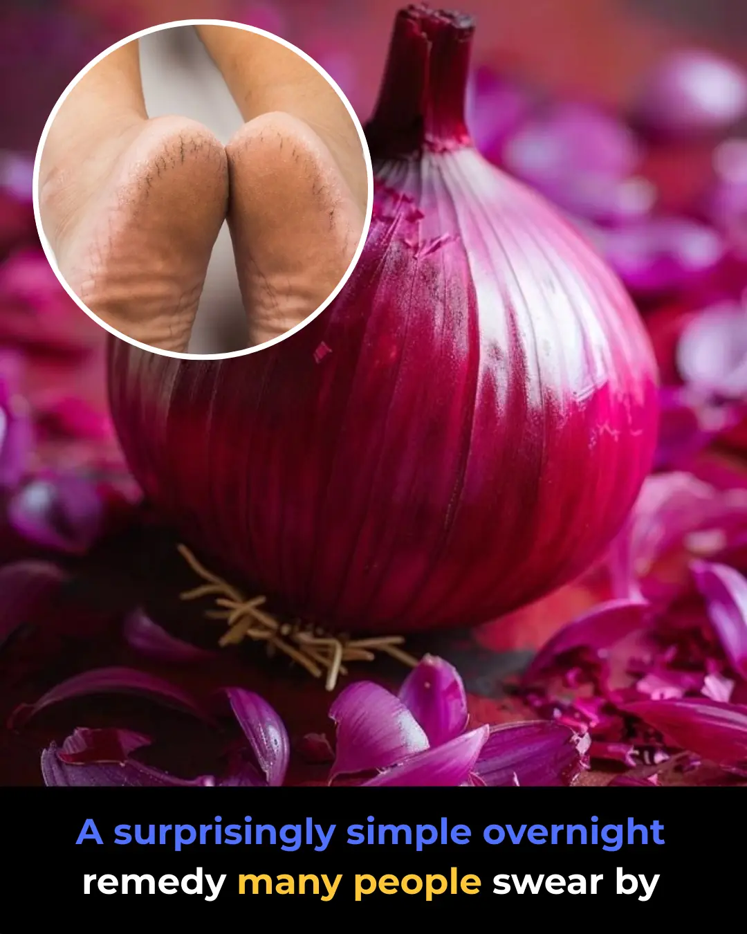 The Overnight Remedy People Swear By for Cracked Heels!