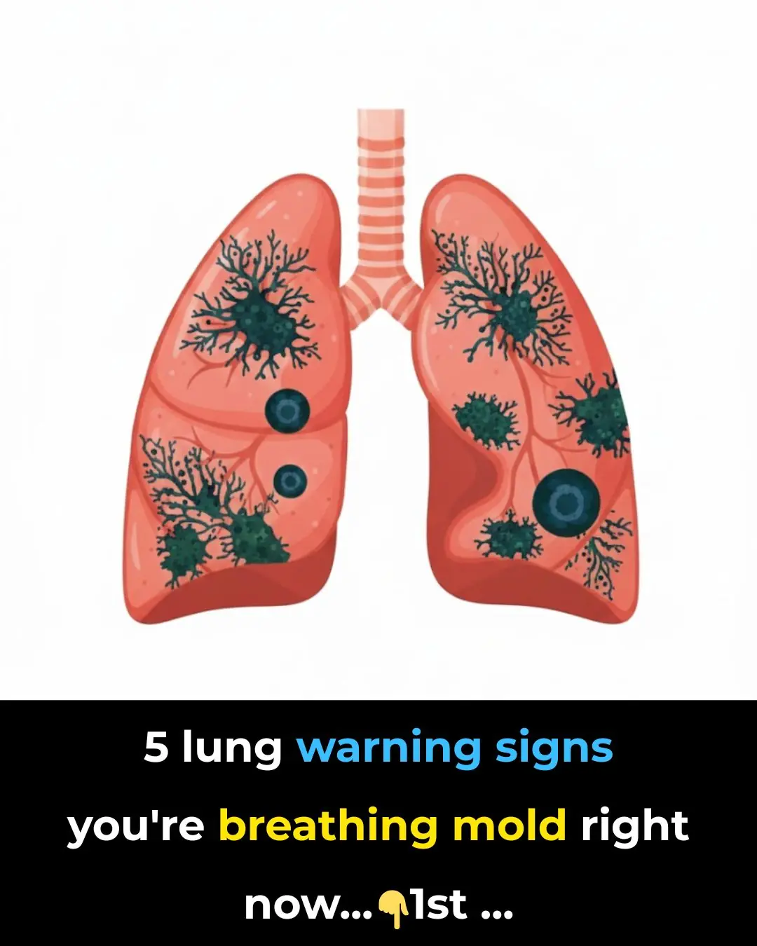 5 Signs Your Lungs are Being Exposed to Mold