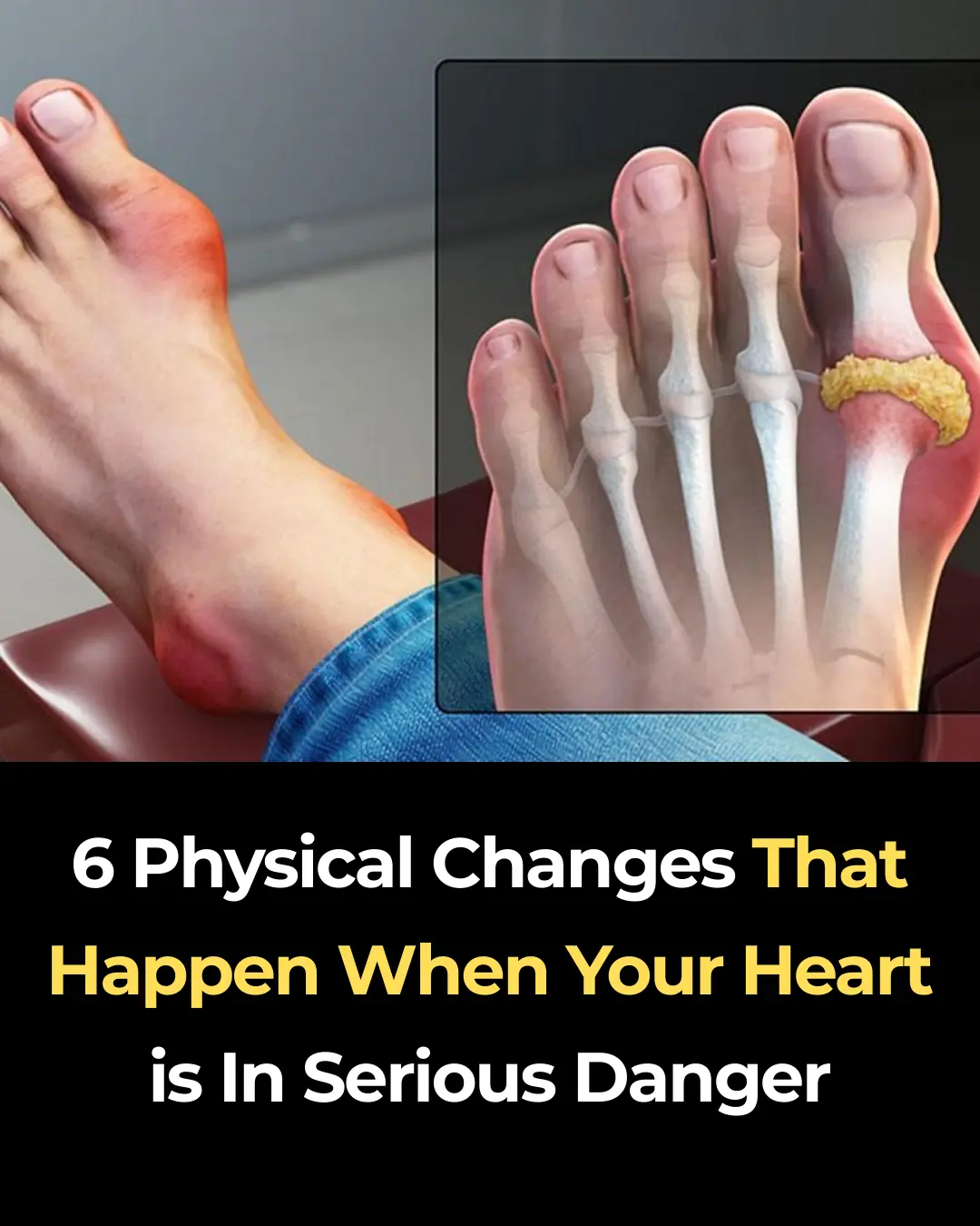 6 Physical Changes That Happen When Your Heart is In Serious Danger