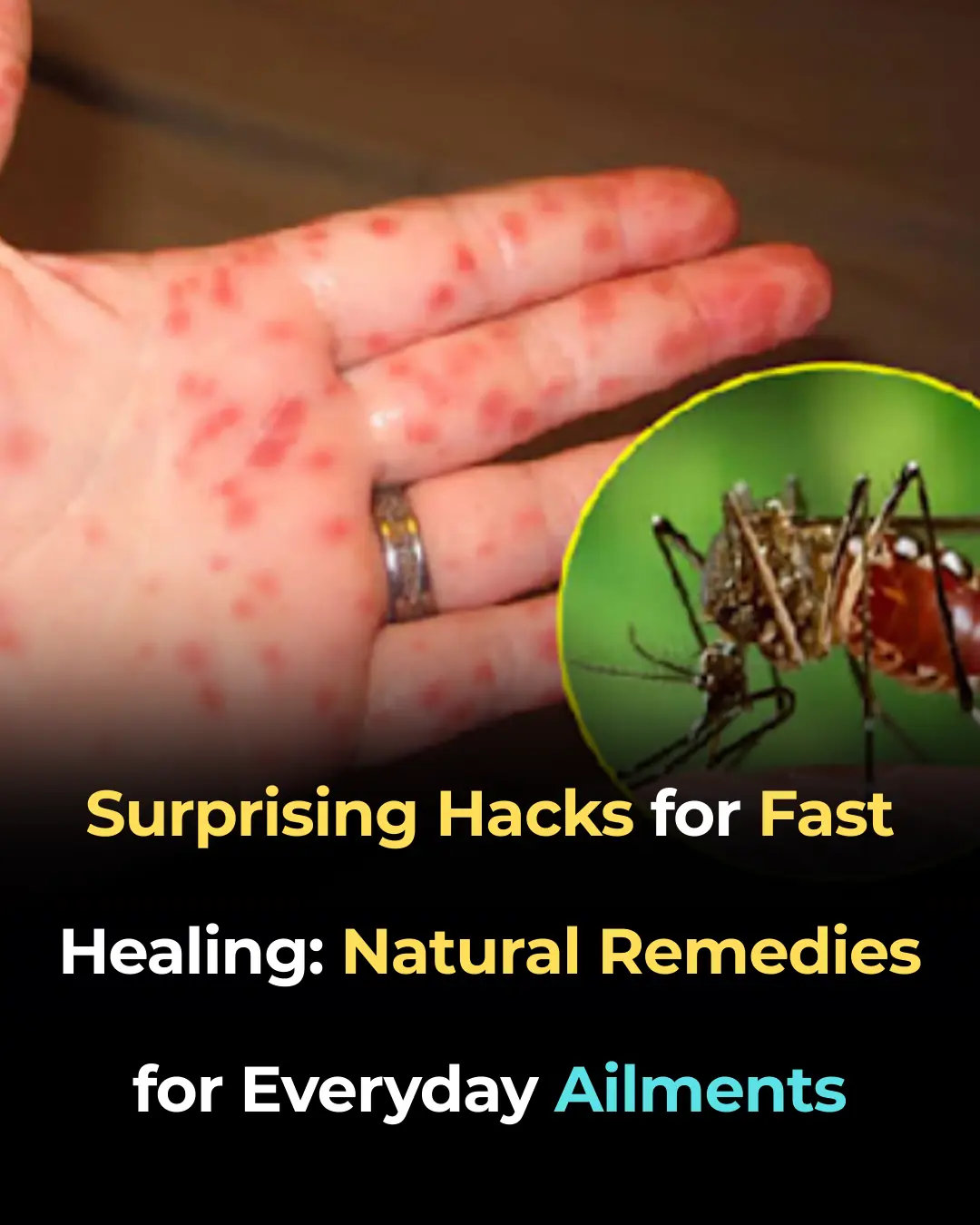 Surprising Hacks for Fast Healing: Natural Remedies for Everyday Ailments