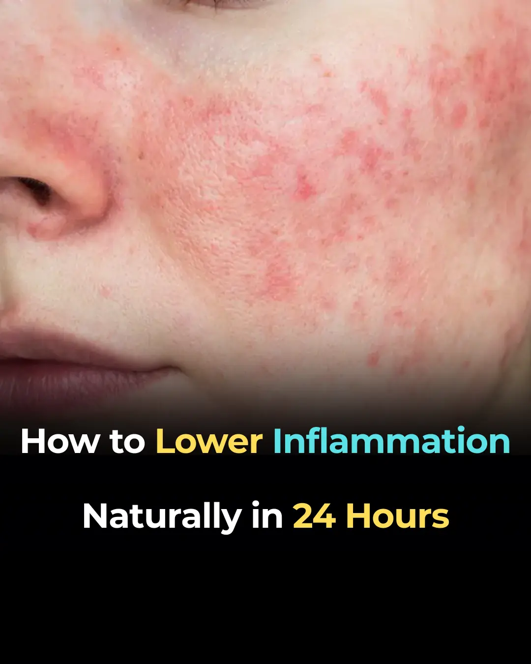 How to Lower Inflammation Naturally in 24 Hours