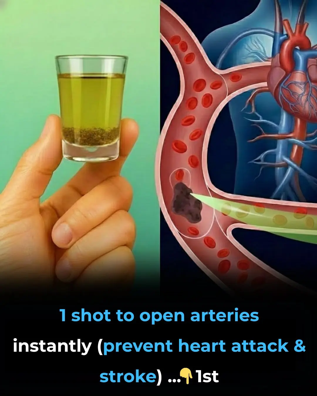 1 shot to open arteries instantly (prevent heart attack & stroke)