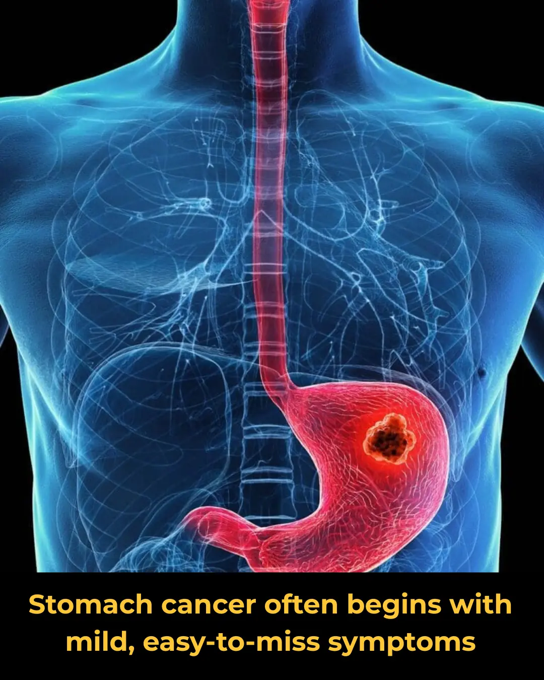 Stomach Cancer: Early Symptoms That Are Easy to Miss