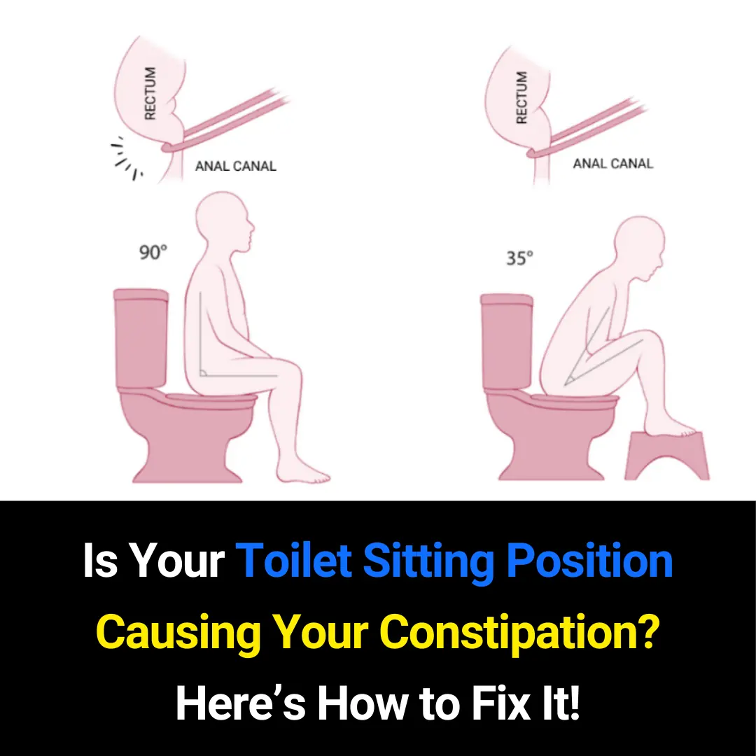 Is Your Toilet Sitting Position Causing Constipation? Here’s How to Fix It Naturally