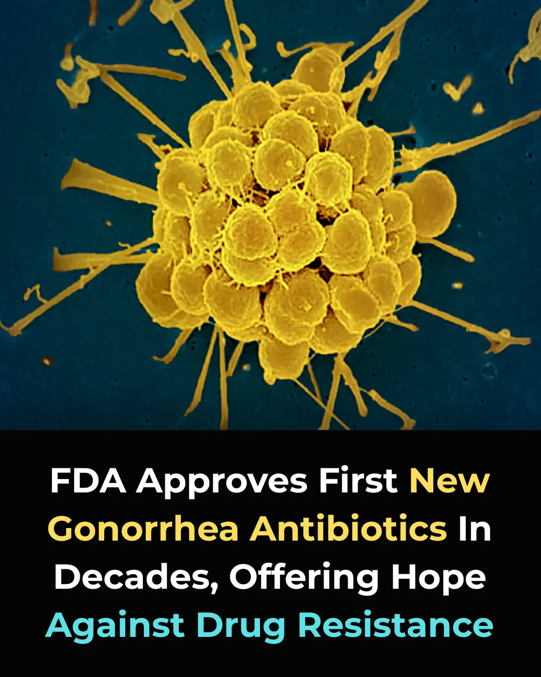 BREAKTHROUGH: FDA Approves First New Gonorrhea Antibiotics in Over 30 Years—A Game-Changer in the Fight Against Drug Resistance