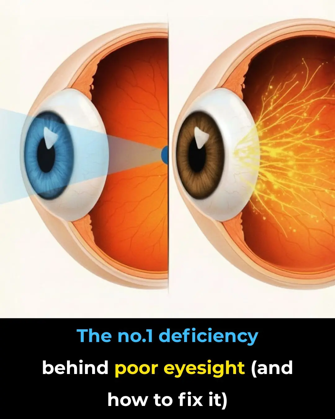 The Hidden Deficiency Ruining Your Eyesight (And How to Fix It)