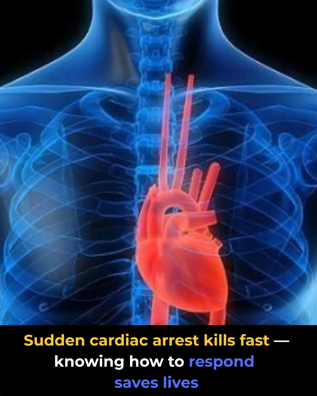 Sudden Cardiac Arrest: What Makes It Deadly and How to Respond