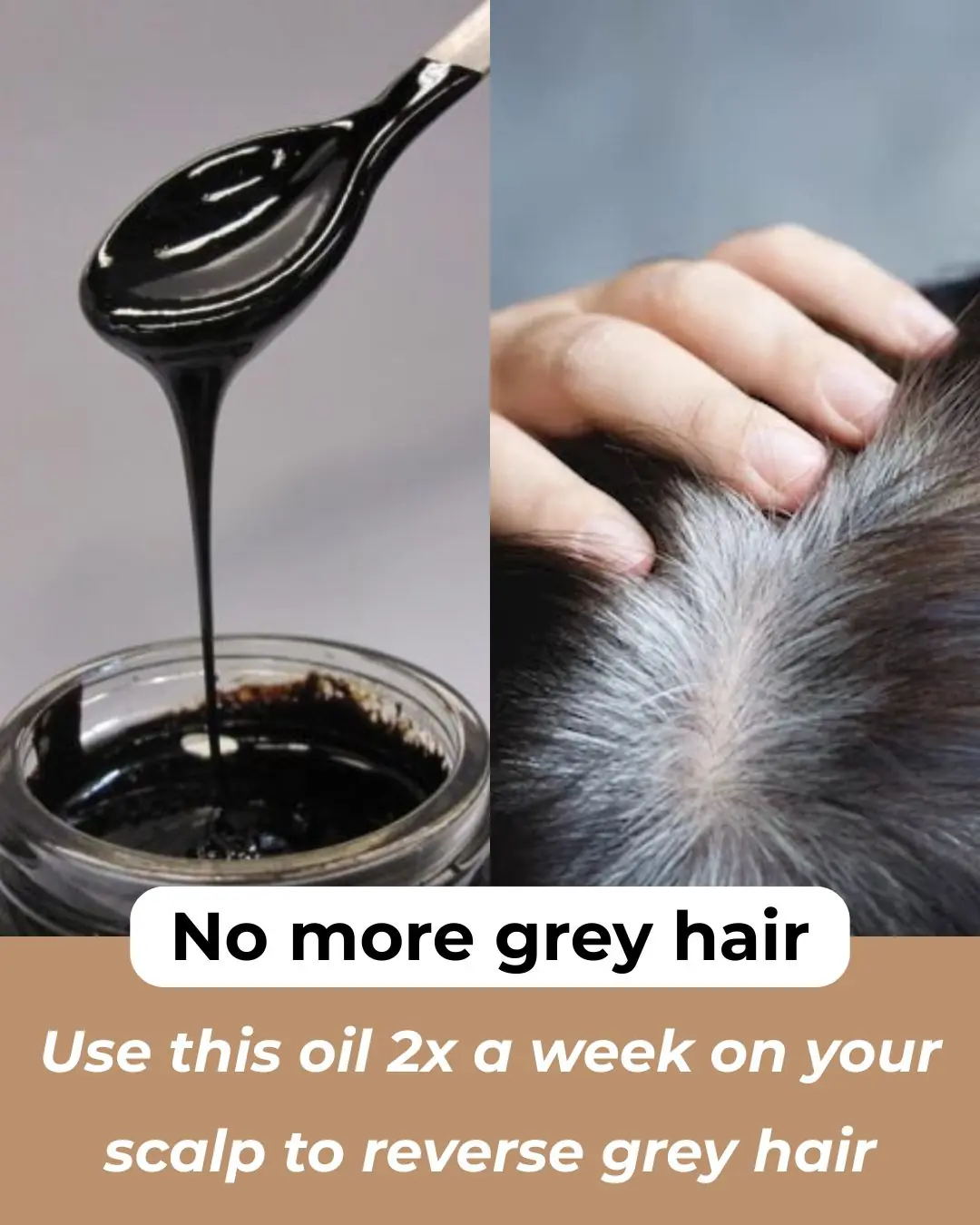 Turmeric and Black Seed Oil: A Natural Remedy for Grey Hair