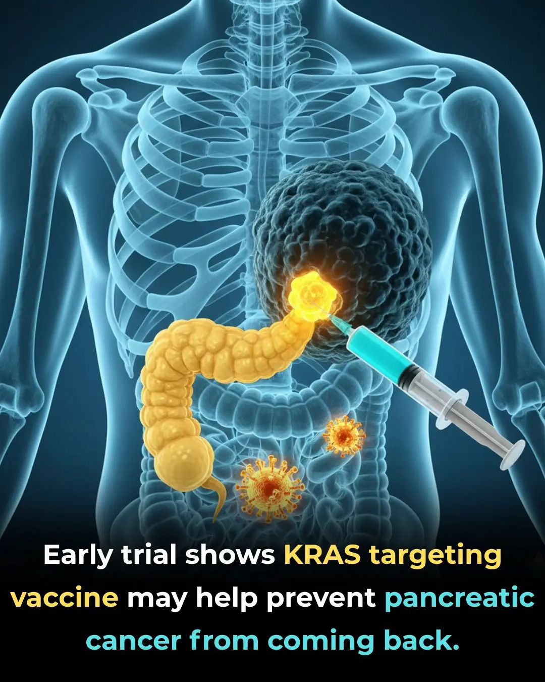 Promising Early Results for ELI-002 2P: A New Vaccine Targeting Pancreatic Cancer