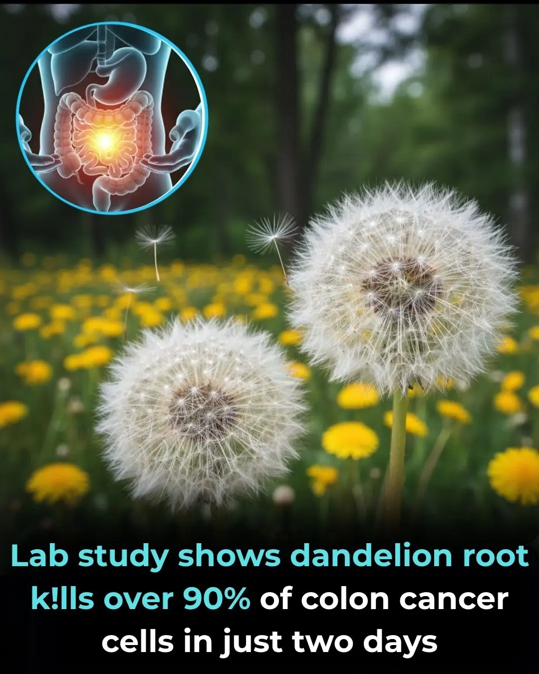 Lab Study Shows Dandelion Root Kills Over 90% of Colon Cancer Cells In Just Two Days