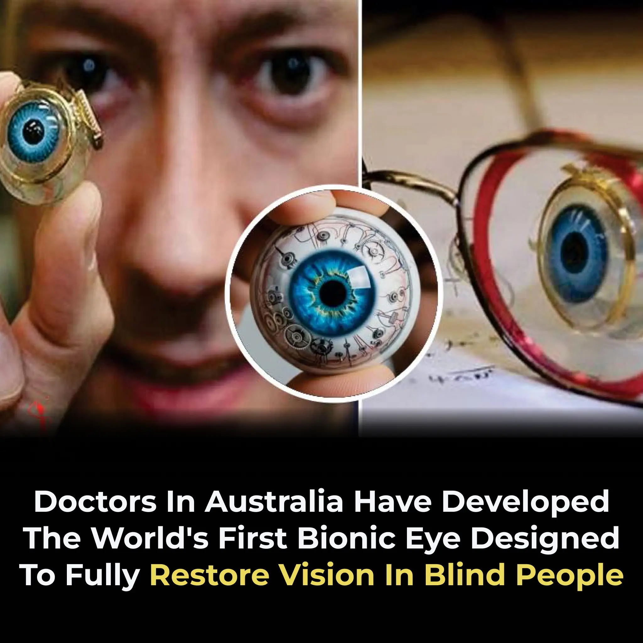 Australia's Revolutionary Bionic Eye: A New Era in Restoring Vision