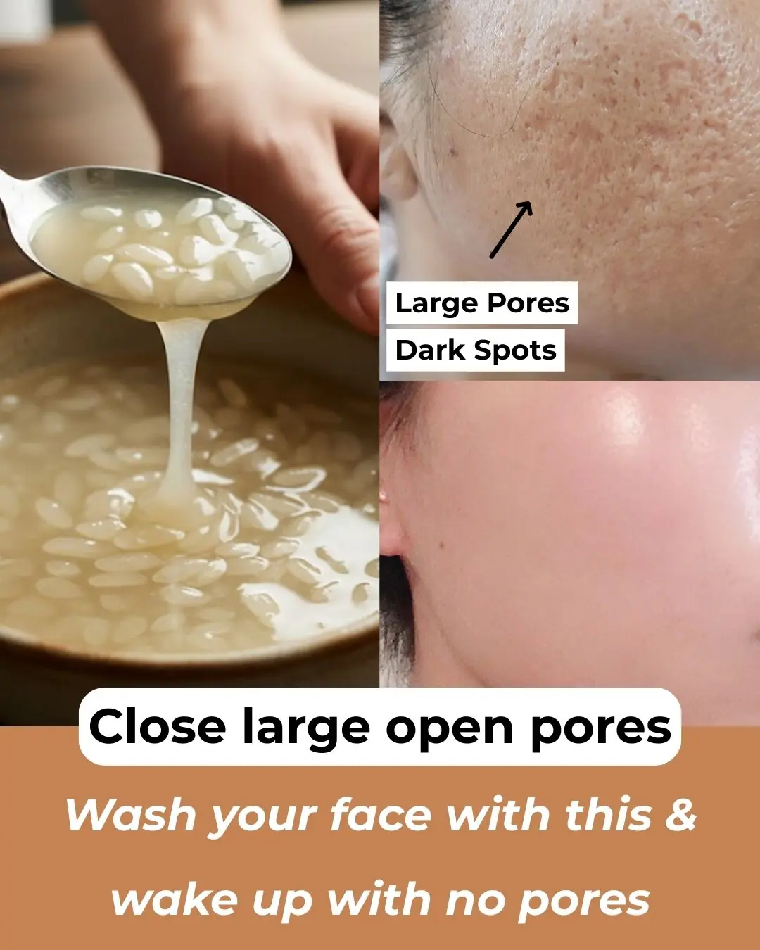 Rice Water Uses for Skin