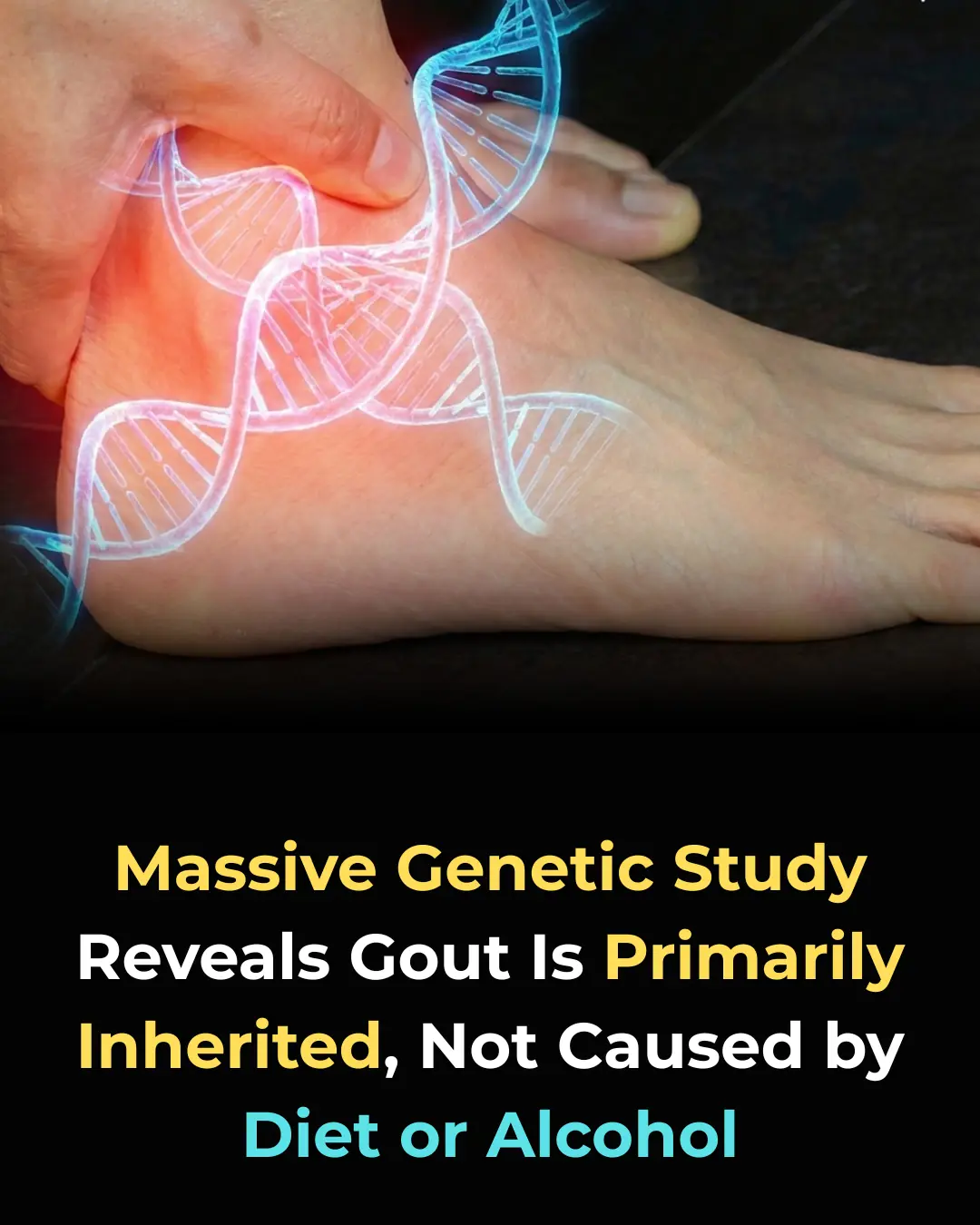 New Genetic Study Uncovers Surprising Truth About Gout: It's Not Just Caused by Diet