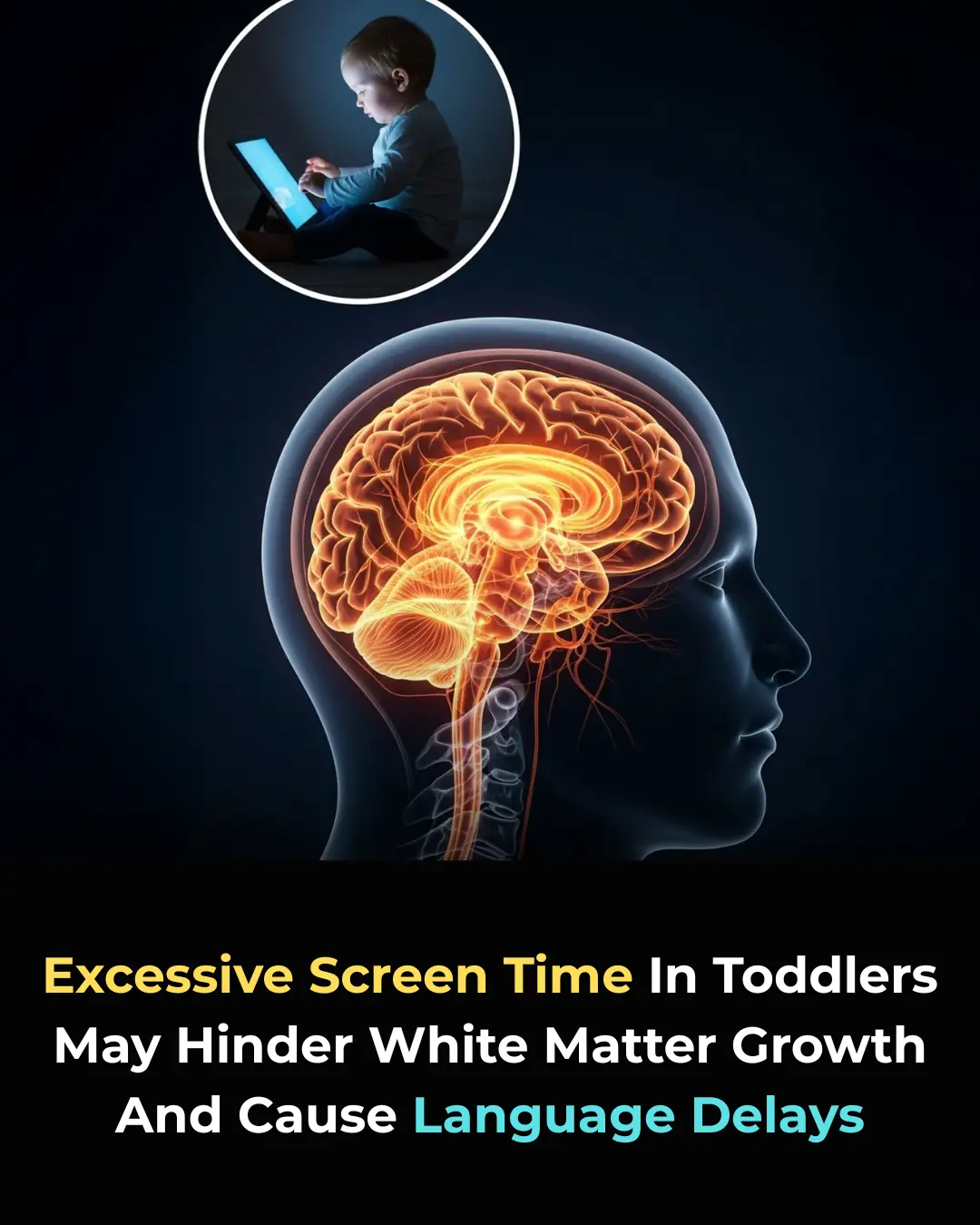 Too Much Screen Time in Toddlers May Damage Brain Growth and Delay Speech—Find Out Why