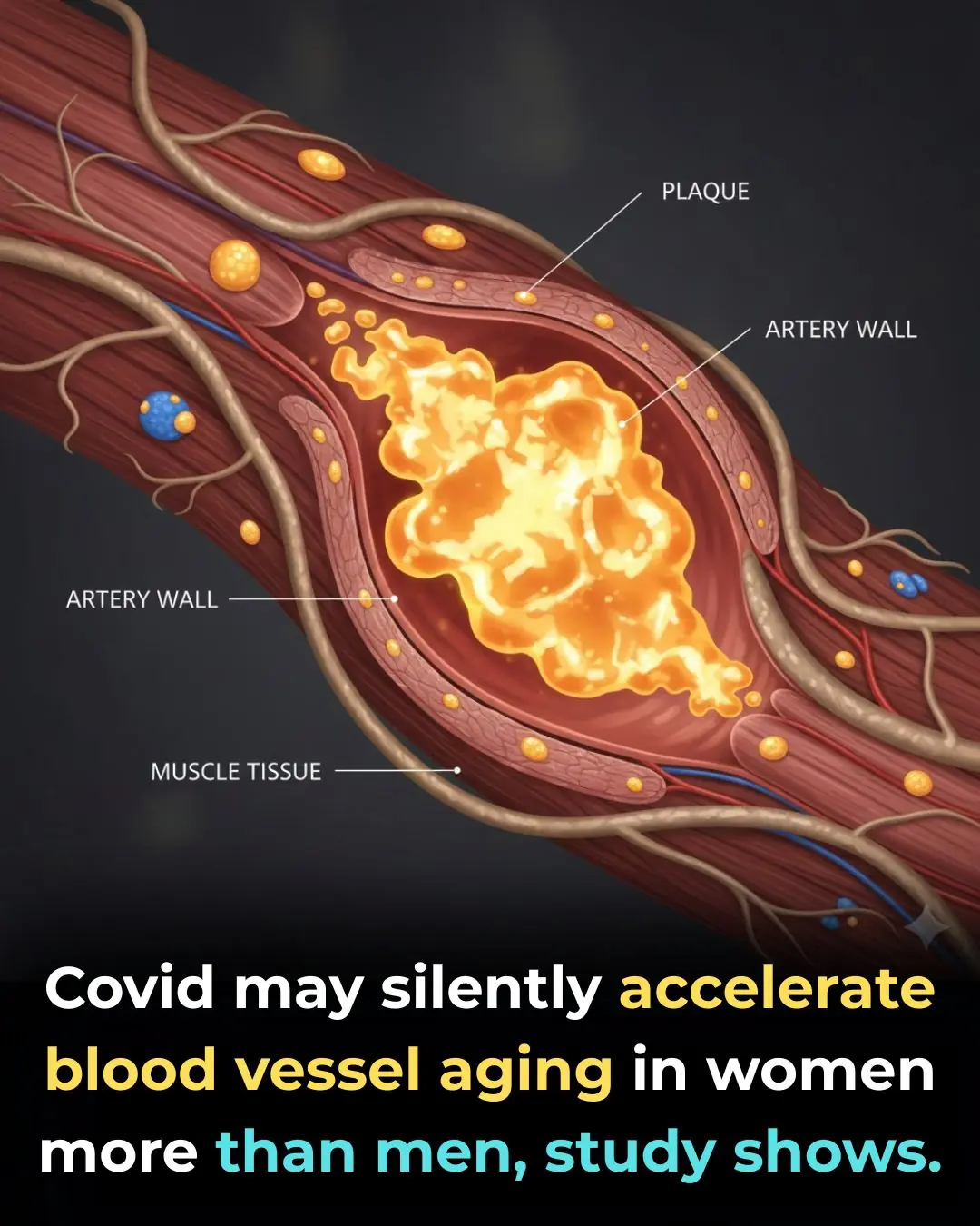 Even Mild Covid Can Age Women’s Arteries by Years, Scientists Warn