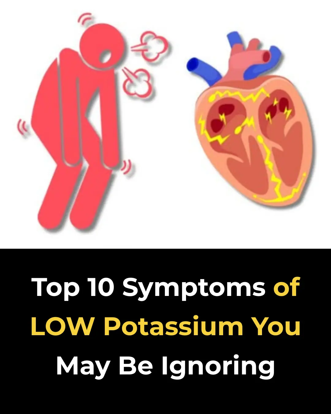 Top 10 Symptoms of LOW Potassium You May Be Ignoring