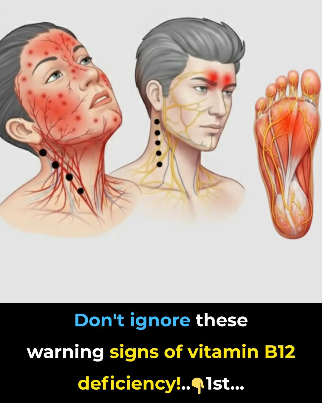 Don’t Ignore These Warning Signs of Vitamin B12 Deficiency!