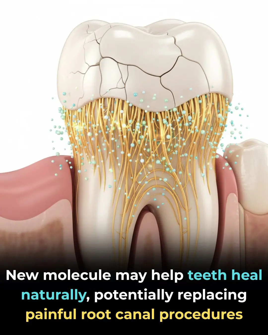 Scientists Discover Molecule That Could Help Teeth Heal Themselves Without Root Canals