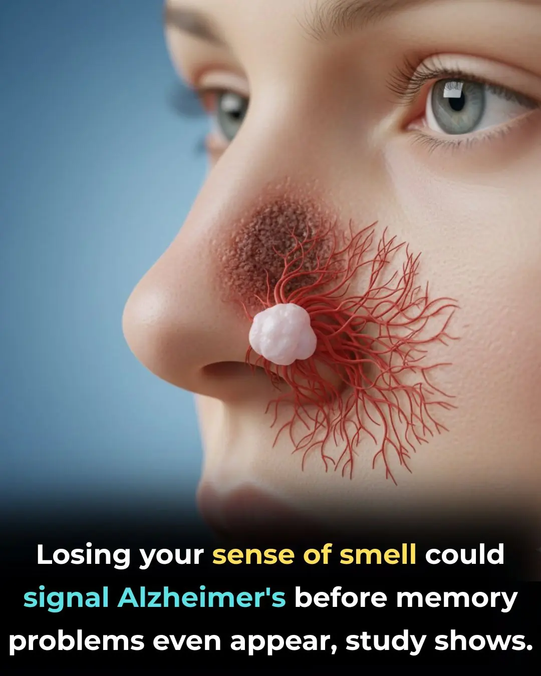 Diminished Sense of Smell as an Early Warning Sign of Alzheimer's Disease: New Research Insights