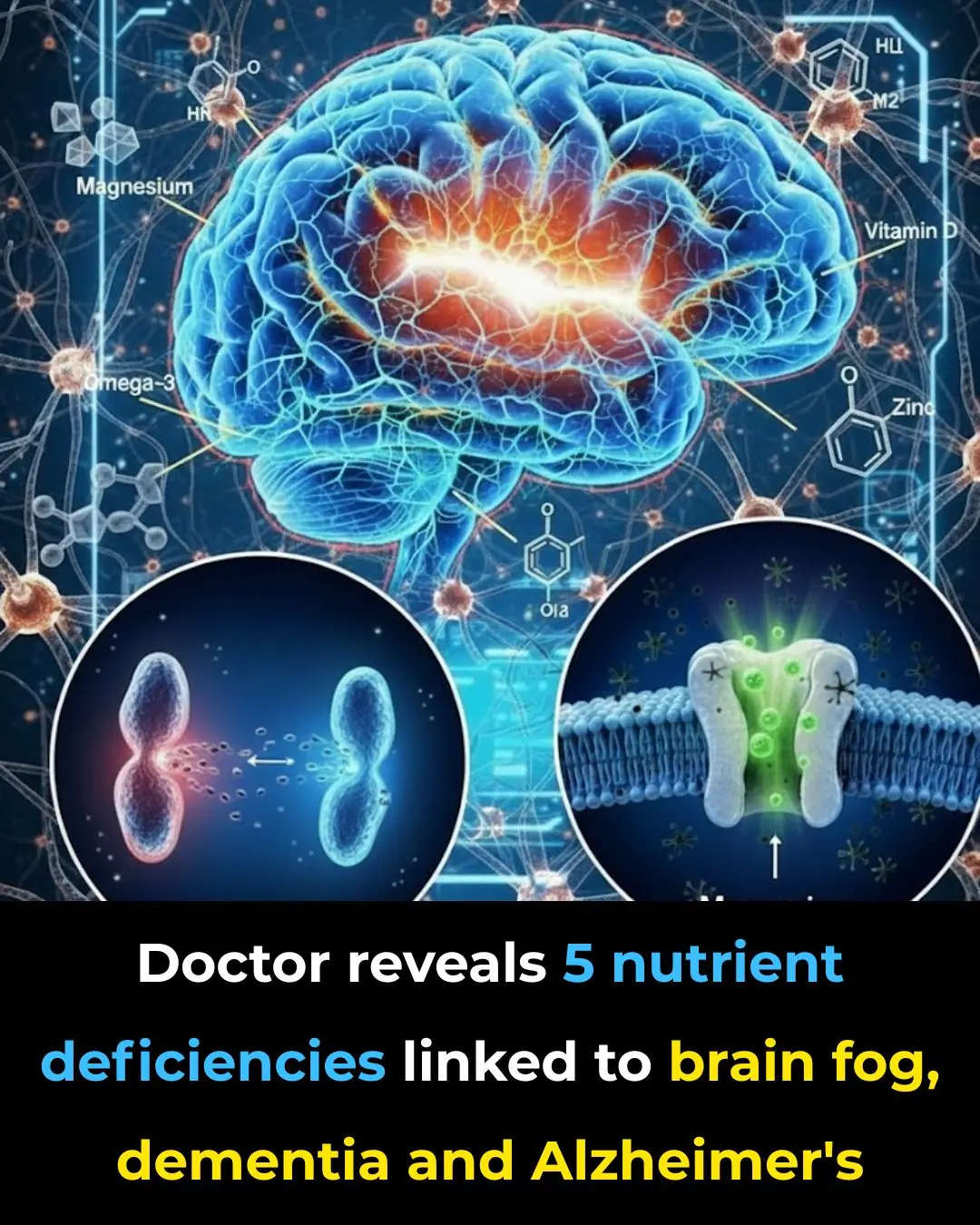 Doctor reveals 5 nutrient deficiencies linked to brain fog, dementia and Alzheimer’s