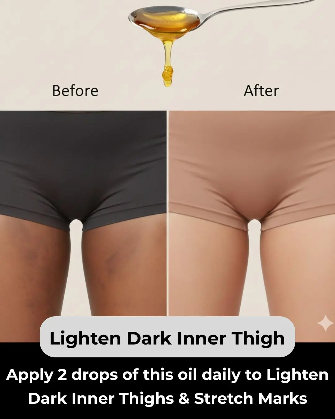 6 Home Remedies to Get Rid of Dark Inner Thighs: Lighten Dark Inner Thighs