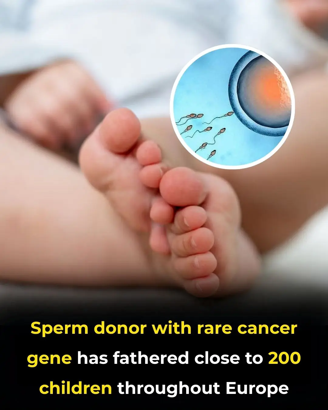 Sperm Donor with Rare Gene Mutation Leads to Urgent Screening Across 14 Countries