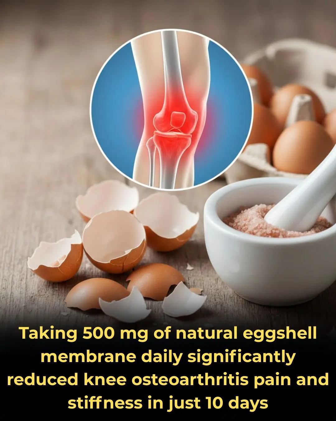 Rapid Pain and Stiffness Relief in Knee Osteoarthritis