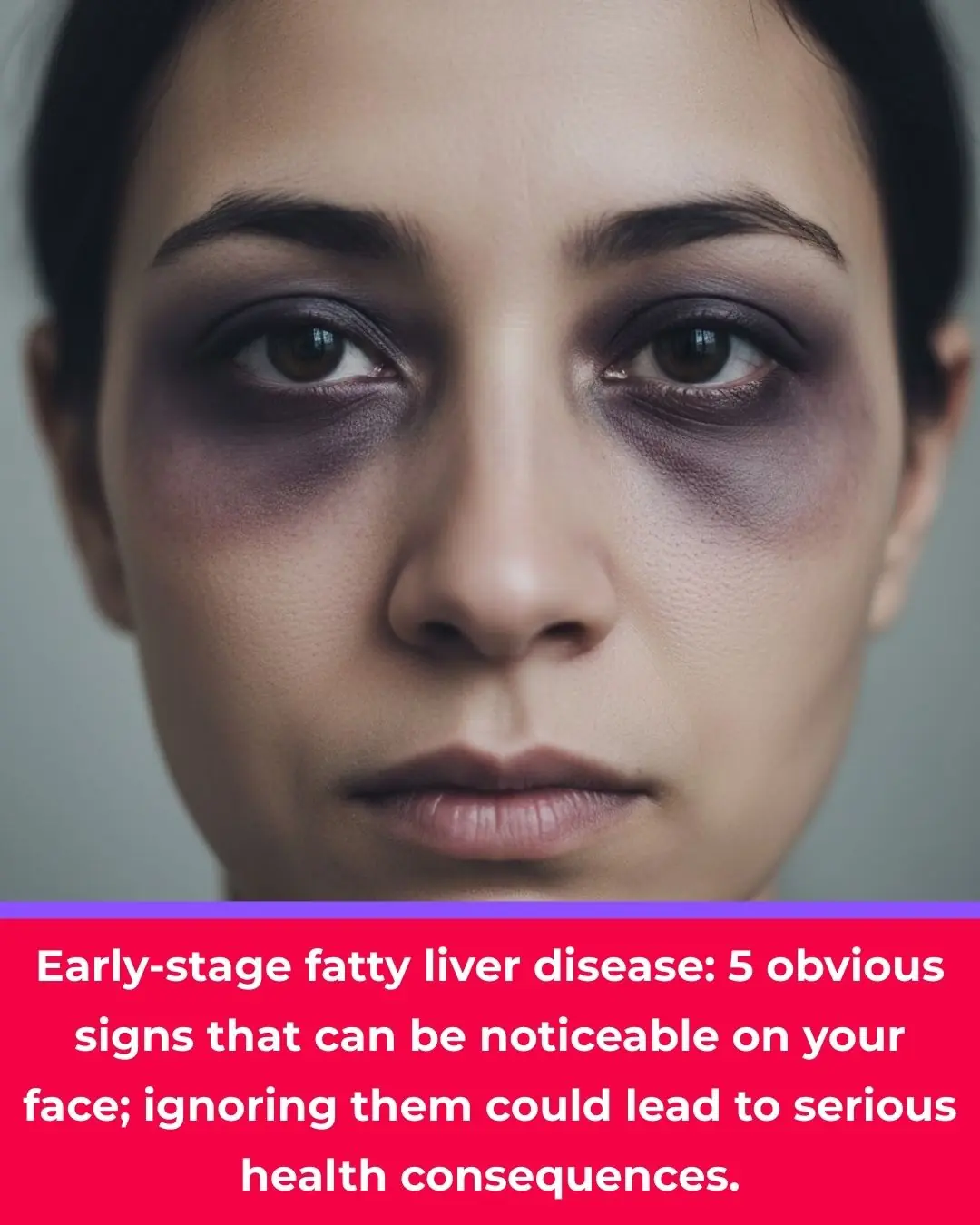 Early-Stage Fatty Liver: 5 Facial Signs You Should Never Ignore