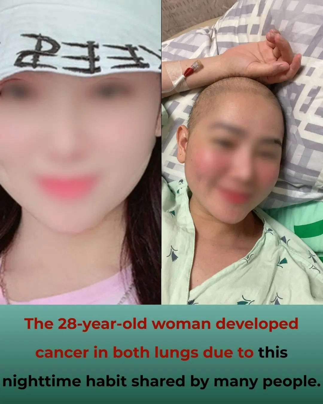 28-Year-Old Woman Develops Lung Cancer in Both Lungs Due to This Common Nighttime Habit