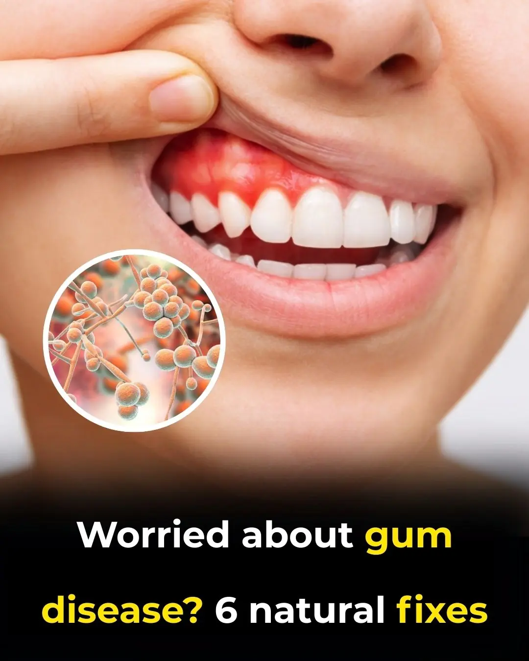 6 Natural Ways To Stop Gum Disease Before It’s Too Late