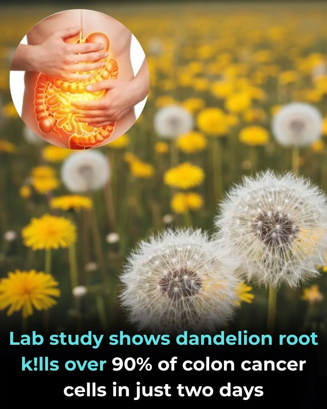 Lab Study Shows Dandelion Root Kills Over 90% of Colon Cancer Cells In Just Two Days